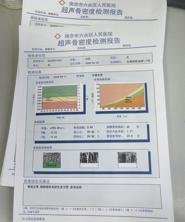 一文了解超声骨密度仪的基本原理、技术特点及应用领域